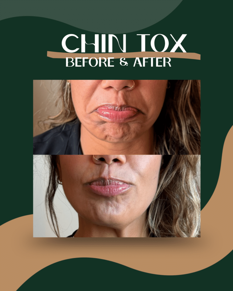 11-chintox