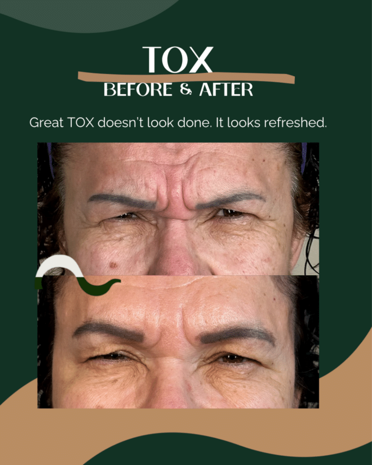 13-tox
