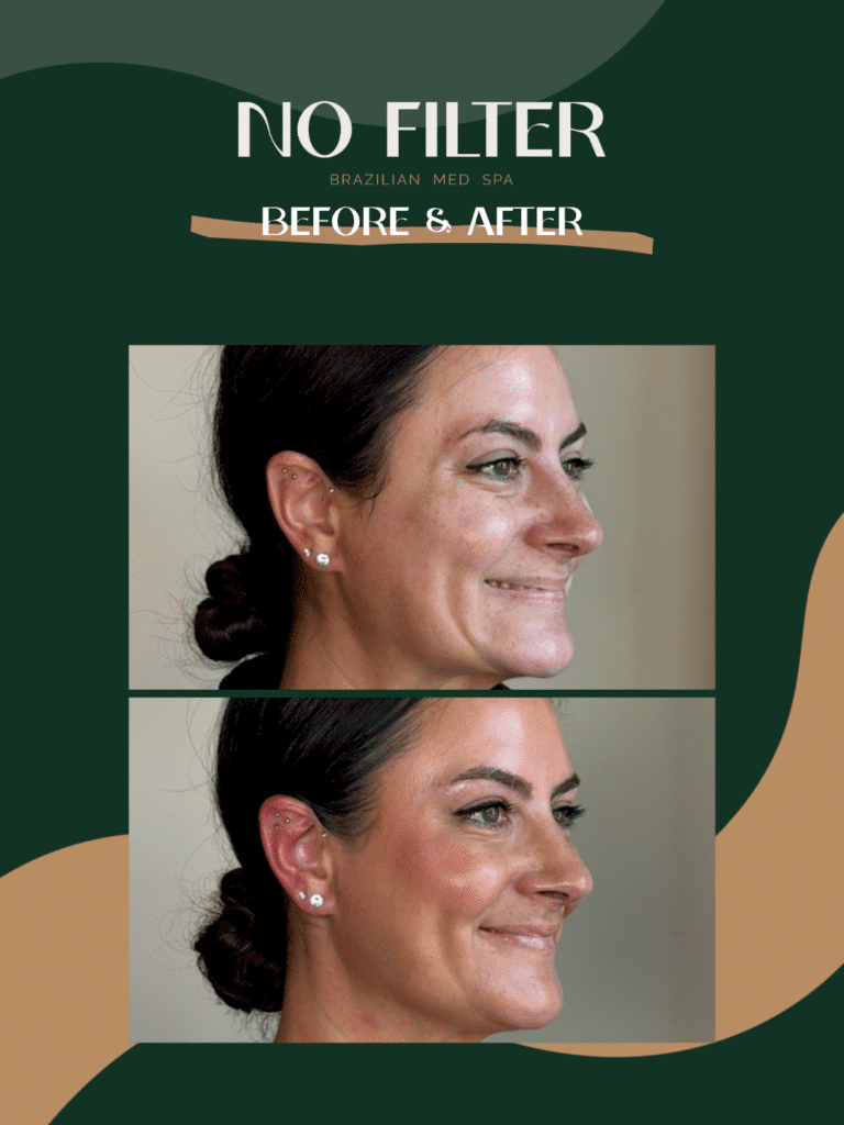 38-Facial