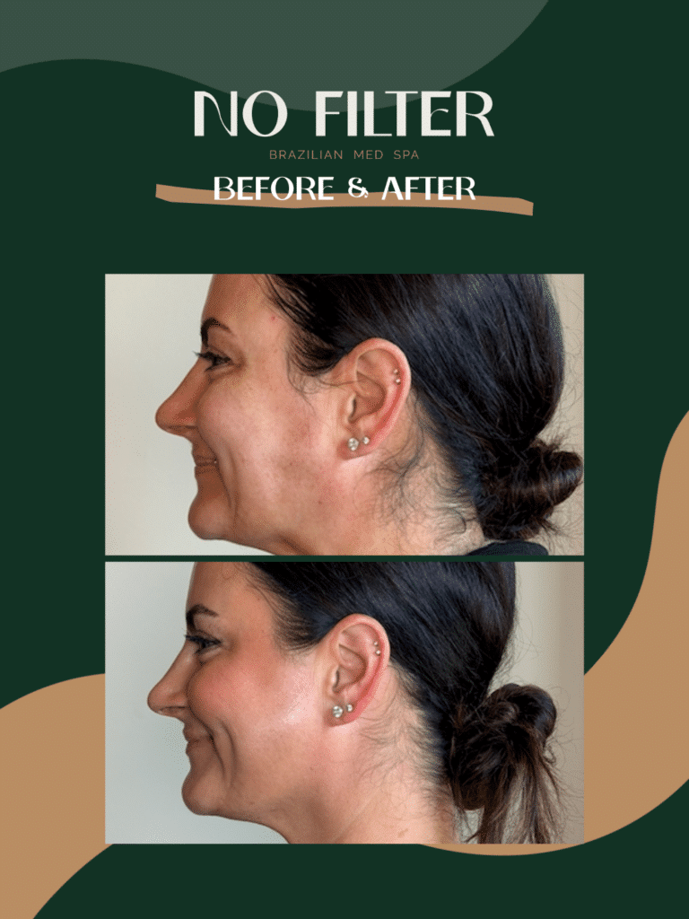 39-Facial