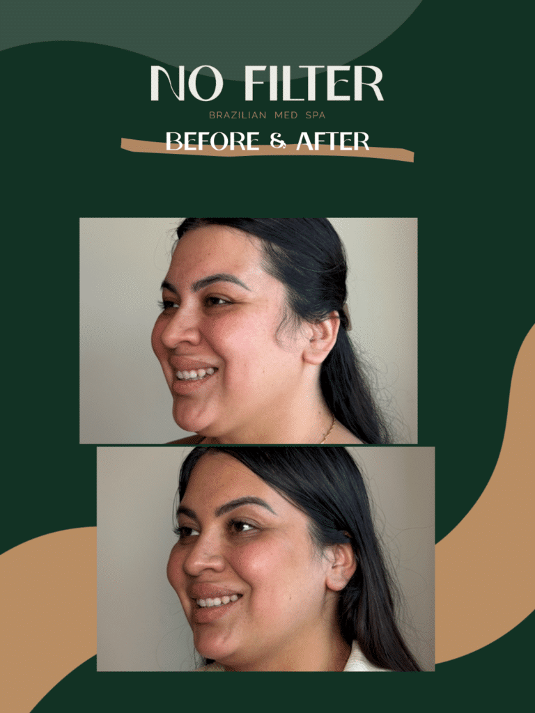 41-Facial
