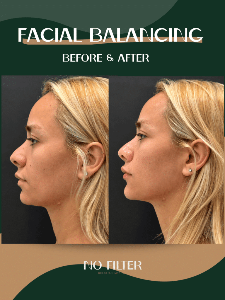 54-facialbalancing